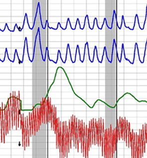 Upland polygraph test